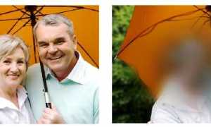 Особенности возрастной макулярной дегенерации сетчатки