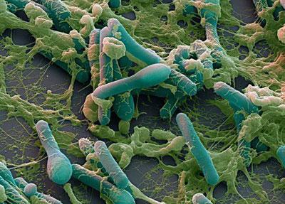 Заражение ботулизмом