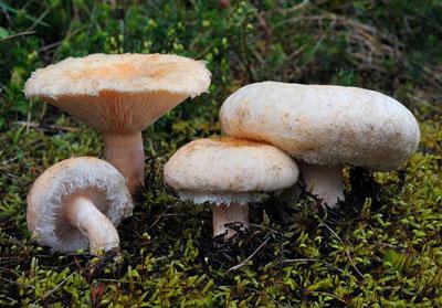 Цифровая флюорография