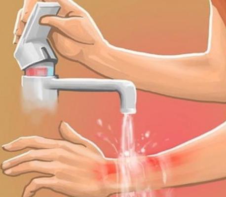 Промыть укус под водой
