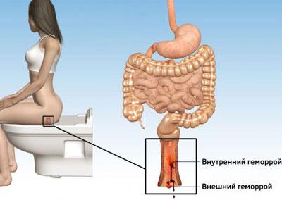 Девушка в истерике