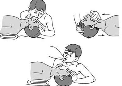 Искусственное дыхание