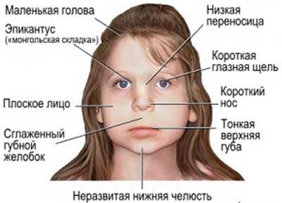 Патология у ребенка при алкоголизме родителей