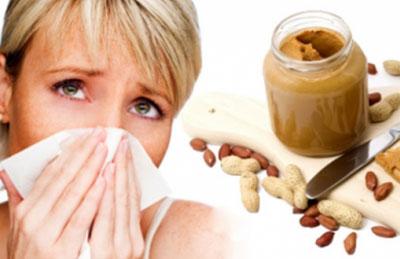 Пищевая аллергия