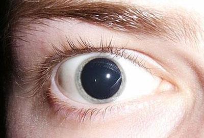 Расширение зрачка