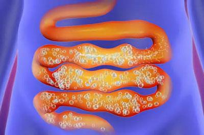 Повышенное газообразование