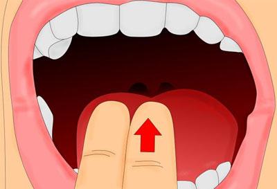 Вызов рвоты