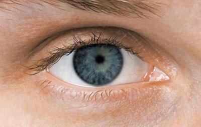 Суженный зрачок