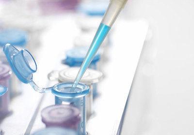 Исследование липидограмма