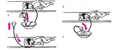 Особенности клинической картины и возможные причины рвоты у ребенка