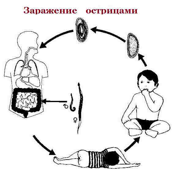 Enterobioz-zarazhenie.jpg