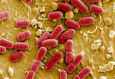 Возбудитель эшерихиоза