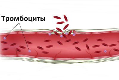 Плохая свертываемость крови