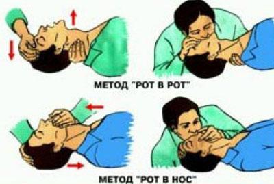 Искусственное дыхание