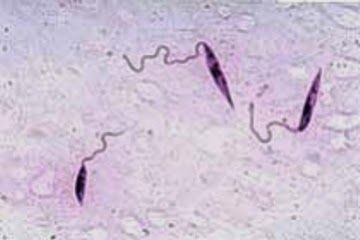Leishmania-braziliensis1.jpg