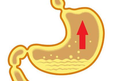 Повышенная кислотность