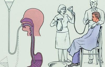 Промывание желудка через зонд