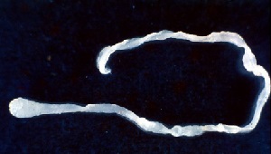 Spirometra_erinacei_m.jpg