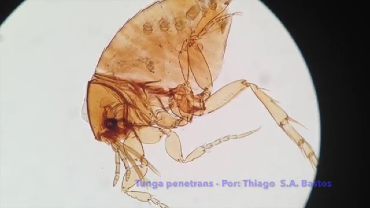 Tunga-penetrans3.jpg