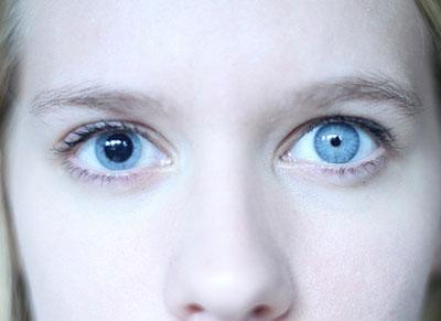 Нормальный и суженый зрачок