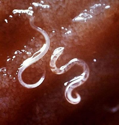 ankilostoma-400x420.jpg