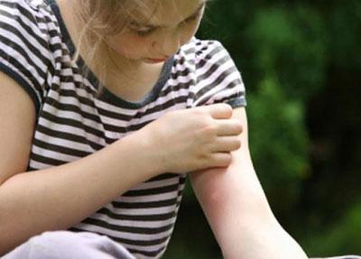 Укус на руке ребенка