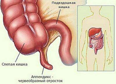 Расположение аппендикса