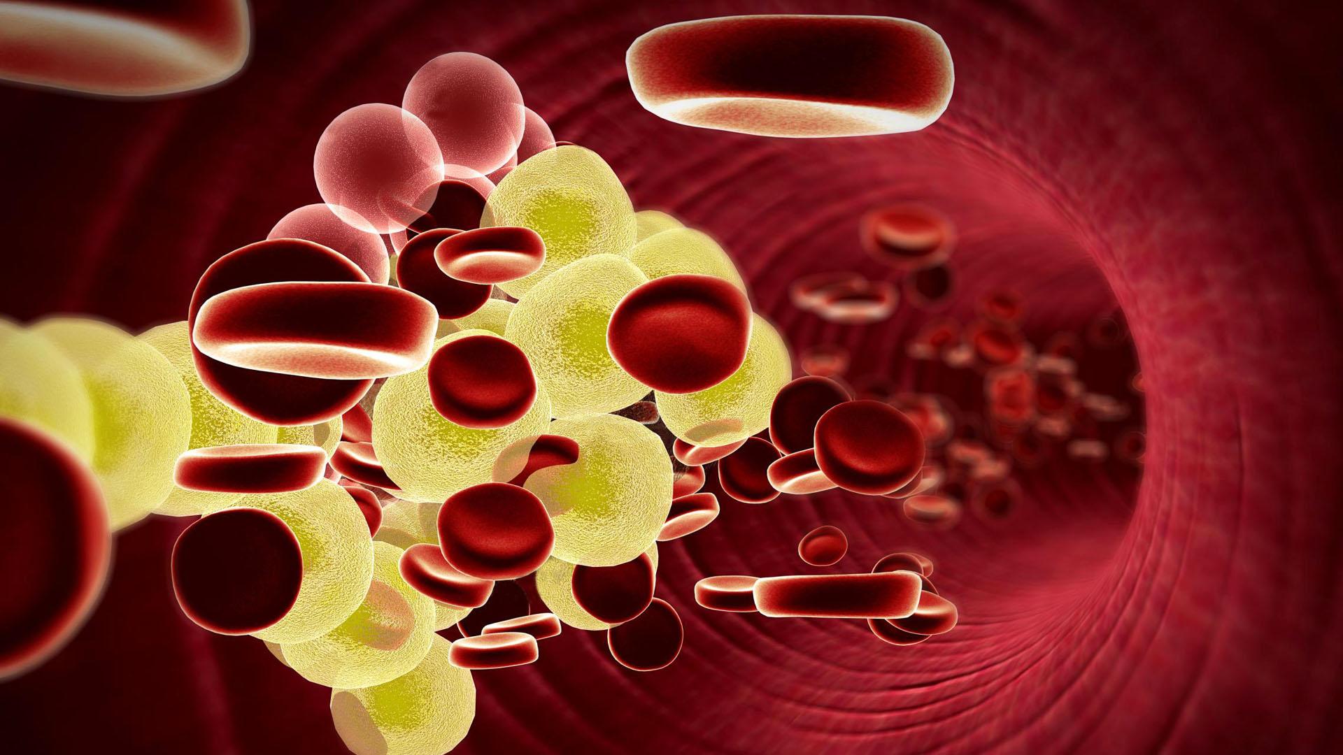 Повышенный уровень холестерина