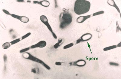 Возбудитель ботулизма