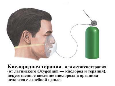 Оксигенотерапия