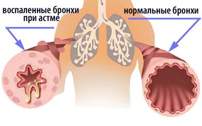 Развитие стмы