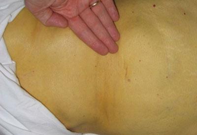 Цвет кожи при желтухе