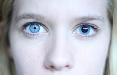 Зрачки при анизокории