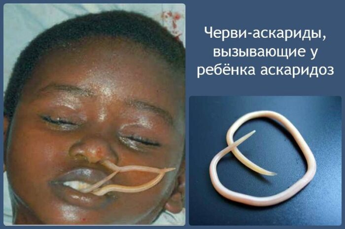 chervi-askaridyi-800x533.jpg