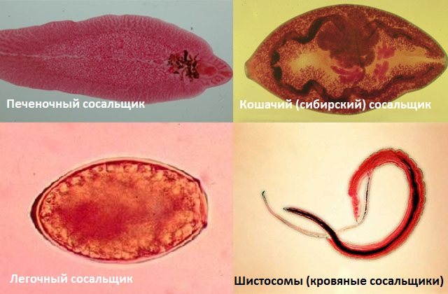 chervi-sosalshchiki-trematody.jpg