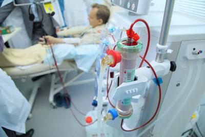 Процедура гемодиализа