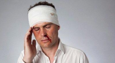 Травмы головы