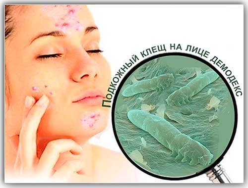 demodex-3.jpg