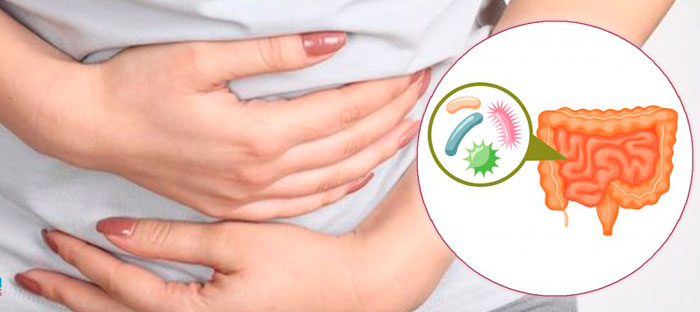 dizbakterioz-kishechnika.jpg