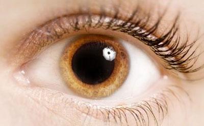 Расширенный зрачок