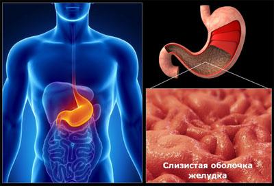 Слизистая при гастрите