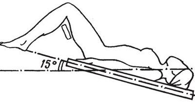 Поза Тренделенбурга