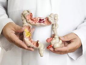 Энтероколит