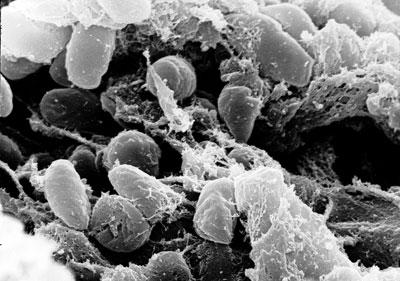 Иерсиниоз под микроскопом