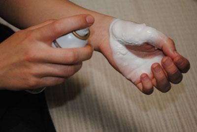 Спрей от ожога