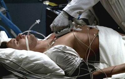 Алкогольная кома