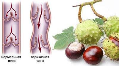 Конский каштан и варикоз