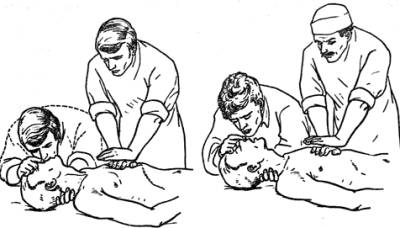 Сердечно-легочная реанимация