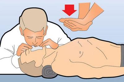 Массаж сердца