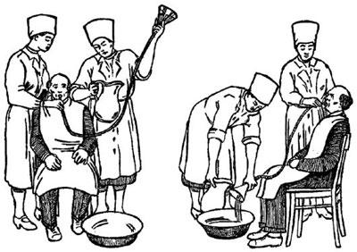 Промывание желудка